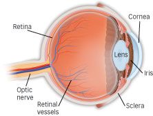 Myopia of the eye diagram